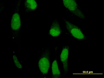 PRPH monoclonal antibody (M02), clone 3B3