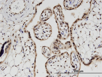 PRPH monoclonal antibody (M02), clone 3B3
