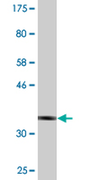 PRPH monoclonal antibody (M02), clone 3B3