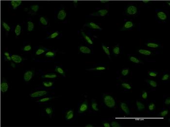 PROX1 monoclonal antibody (M02), clone 1E7