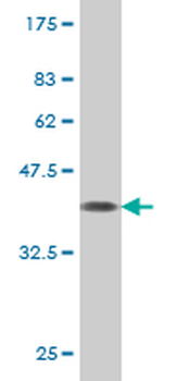 PROX1 monoclonal antibody (M02), clone 1E7