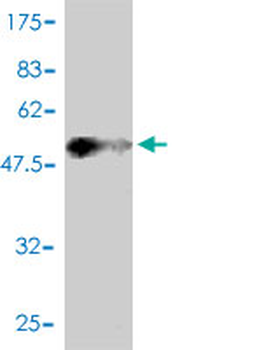DNAJC3 monoclonal antibody (M01), clone 4D3-F2