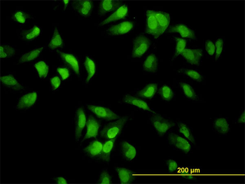 EIF2AK2 monoclonal antibody (M01), clone 1B9