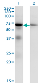 EIF2AK2 monoclonal antibody (M01), clone 1B9