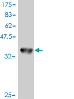 MAP2K1 monoclonal antibody (M01), clone 1B5