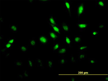 MAPK6 monoclonal antibody (M02), clone 4C11