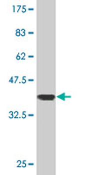 MAPK6 monoclonal antibody (M02), clone 4C11