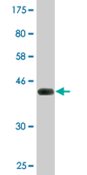 SRGN monoclonal antibody (M03), clone 1D8