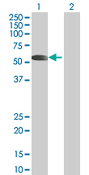 PPP5C MaxPab mouse polyclonal antibody (B01)