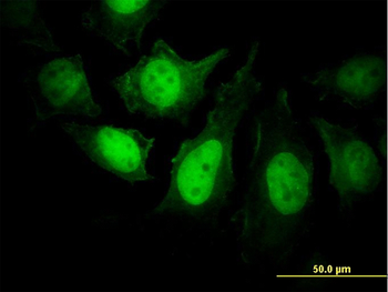 PPP3R1 monoclonal antibody (M01), clone 4E1