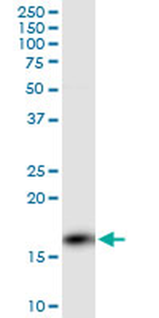 PPP3R1 monoclonal antibody (M01), clone 4E1