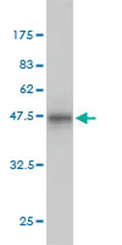 PPP3R1 monoclonal antibody (M01), clone 4E1