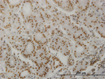 PPP3CA monoclonal antibody (M03), clone 2G8