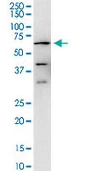 PPP3CA monoclonal antibody (M03), clone 2G8