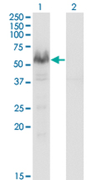 PPP3CA monoclonal antibody (M03), clone 2G8