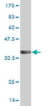 PPP3CA monoclonal antibody (M03), clone 2G8