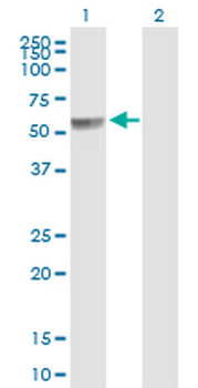PPP2R5A purified MaxPab mouse polyclonal antibody (B01P)