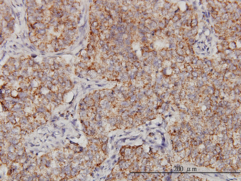 PPOX monoclonal antibody (M01), clone 2F10