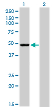 PPOX monoclonal antibody (M01), clone 2F10