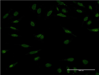 PPM1A monoclonal antibody (M03), clone 4E11