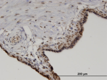 PPM1A monoclonal antibody (M03), clone 4E11