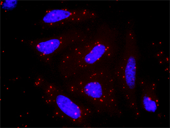 PPM1A monoclonal antibody (M03), clone 4E11