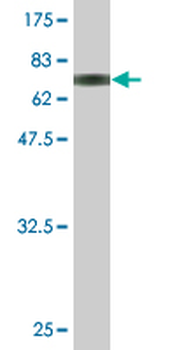 PPM1A monoclonal antibody (M03), clone 4E11