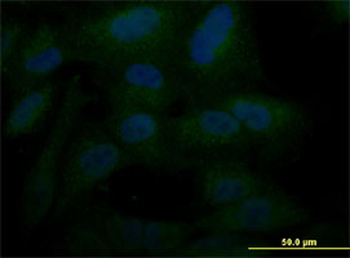 POU5F1 monoclonal antibody (M05), clone 1B11