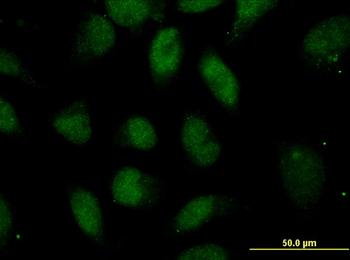 POU5F1 monoclonal antibody (M05), clone 1B11