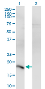 POU5F1 monoclonal antibody (M05), clone 1B11