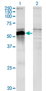 POU3F2 monoclonal antibody (M01), clone 6F6