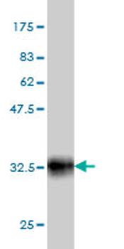POU3F2 monoclonal antibody (M01), clone 6F6