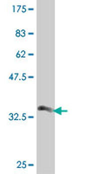 PMM2 polyclonal antibody (A01)