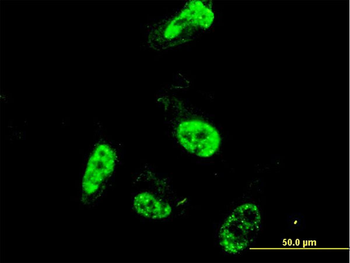 PML monoclonal antibody (M02), clone 1D12