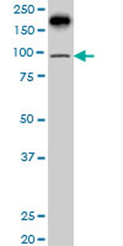 PML monoclonal antibody (M02), clone 1D12
