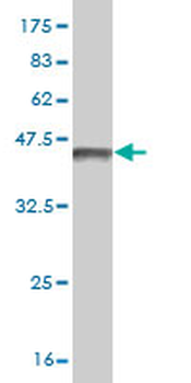 PML monoclonal antibody (M02), clone 1D12