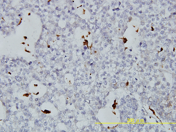PLTP monoclonal antibody (M01), clone 2F3-G4