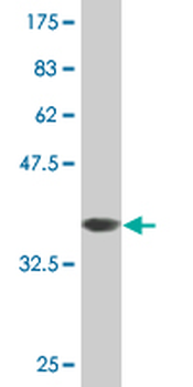 PLS1 monoclonal antibody (M04), clone 3G10