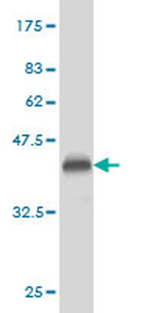PLD2 monoclonal antibody (M01), clone 1C5