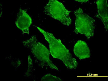 PLCG1 monoclonal antibody (M01), clone 2A2