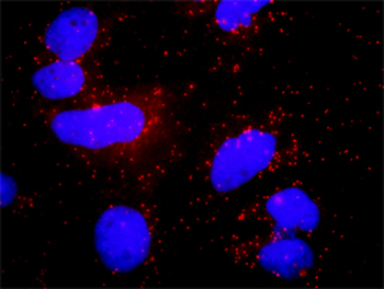 PLCG1 monoclonal antibody (M01), clone 2A2