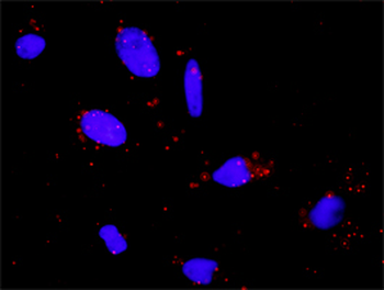 PLCG1 monoclonal antibody (M01), clone 2A2