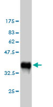 PLCG1 monoclonal antibody (M01), clone 2A2