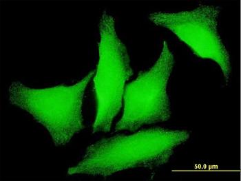 PKD2 monoclonal antibody (M01), clone 4C8
