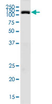 PKD2 monoclonal antibody (M01), clone 4C8
