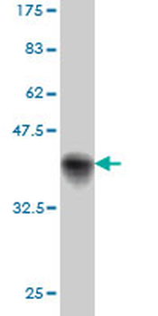 PKD2 monoclonal antibody (M01), clone 4C8