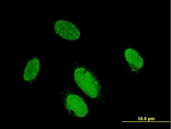 PITX2 monoclonal antibody (M01), clone 2G6