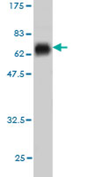 PITX2 monoclonal antibody (M01), clone 2G6