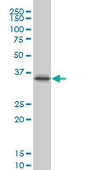 PITX1 monoclonal antibody (M02), clone 6D4