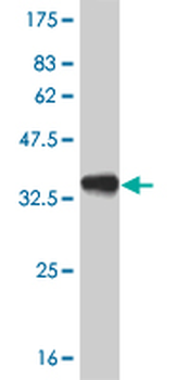 PITX1 monoclonal antibody (M02), clone 6D4